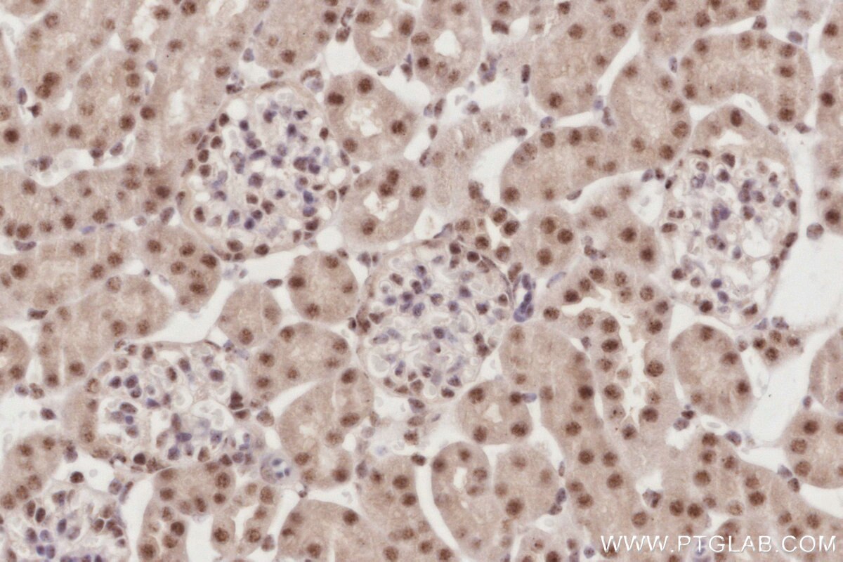 Immunohistochemical analysis of paraffin-embedded mouse kidney tissue slide using KHC2916 (SENP3 IHC Kit).