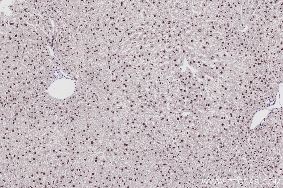 Immunohistochemical analysis of paraffin-embedded mouse liver tissue slide using KHC2916 (SENP3 IHC Kit).