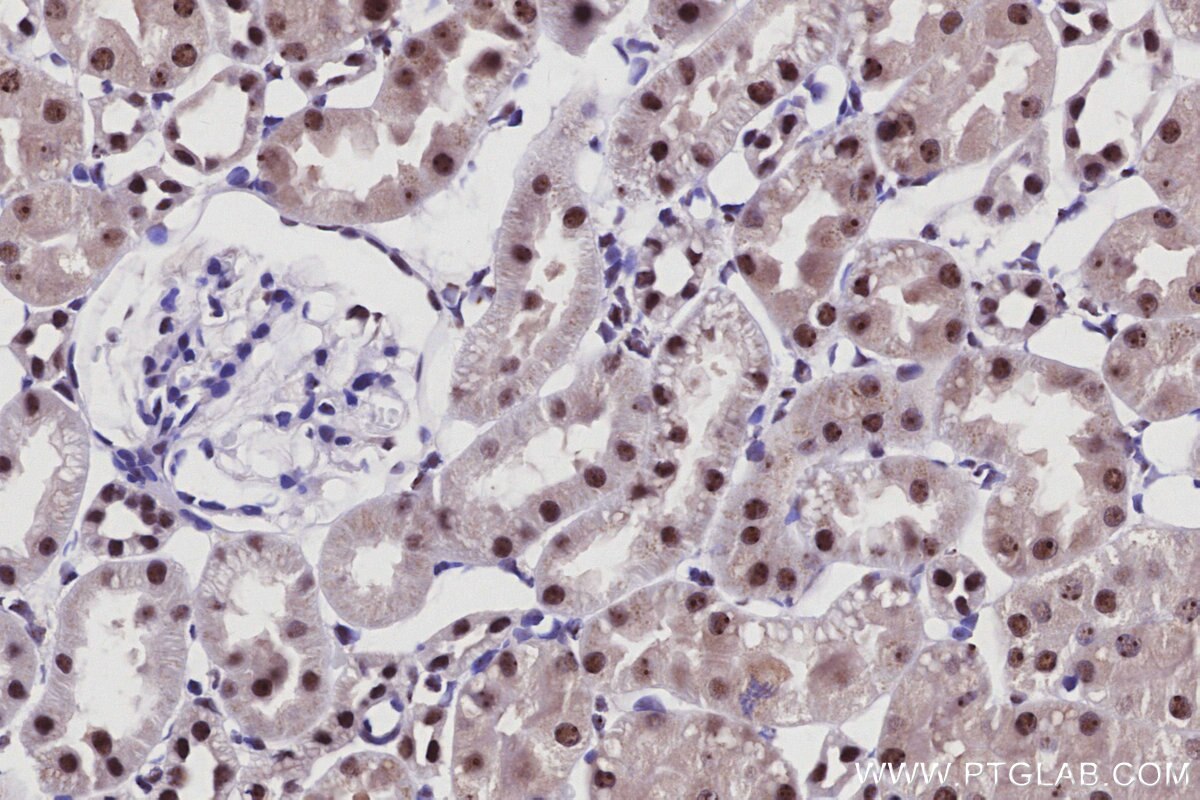 Immunohistochemical analysis of paraffin-embedded rat kidney tissue slide using KHC2916 (SENP3 IHC Kit).