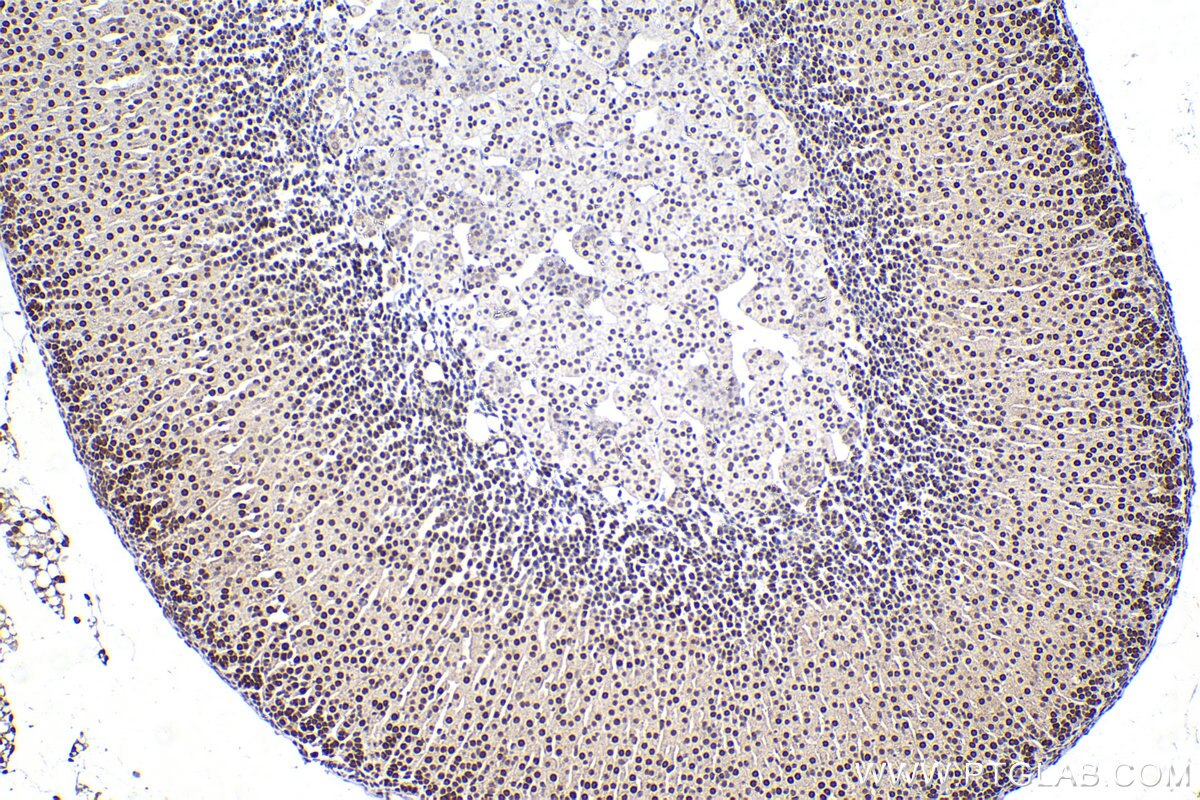 Immunohistochemical analysis of paraffin-embedded mouse adrenal gland tissue slide using KHC2293 (SEPHS1 IHC Kit).