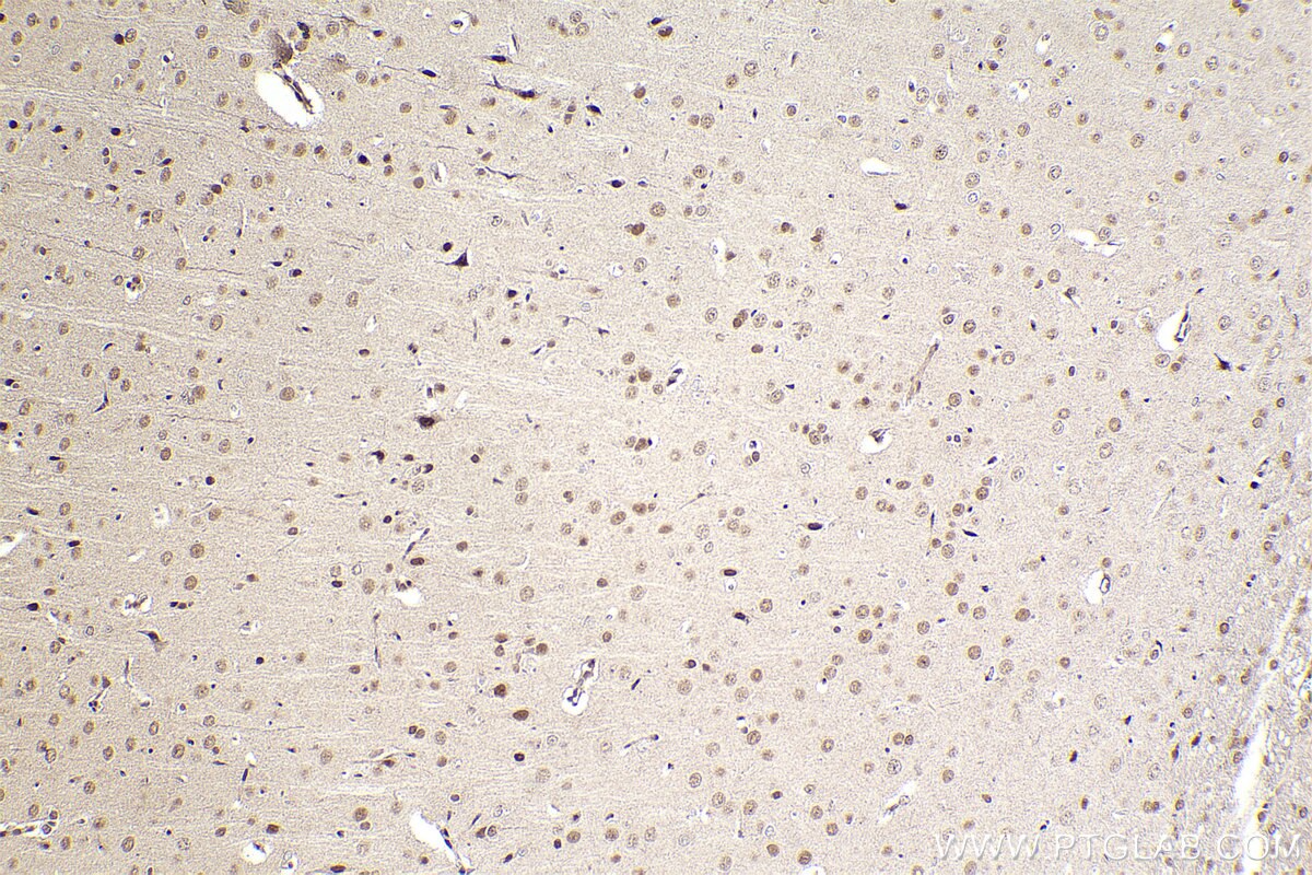 Immunohistochemical analysis of paraffin-embedded rat brain tissue slide using KHC2293 (SEPHS1 IHC Kit).