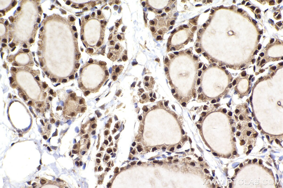 Immunohistochemical analysis of paraffin-embedded rat thyroid gland tissue slide using KHC2293 (SEPHS1 IHC Kit).