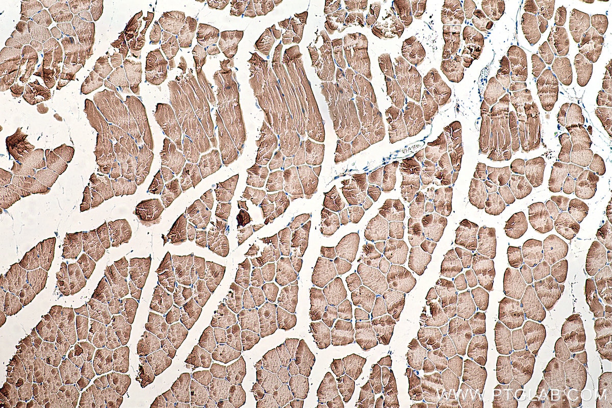 Immunohistochemical analysis of paraffin-embedded mouse skeletal muscle tissue slide using KHC0322 (SEPN1 IHC Kit).