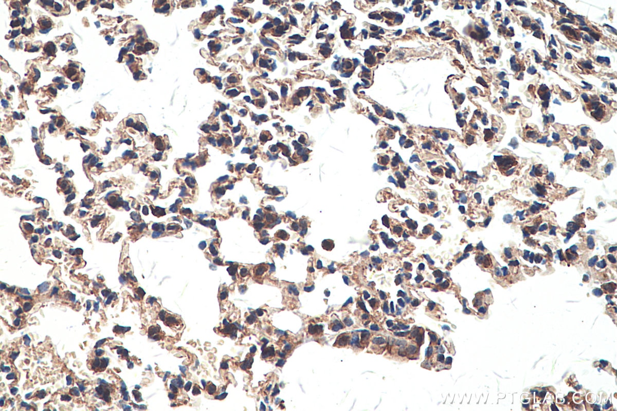 Immunohistochemical analysis of paraffin-embedded mouse lung tissue slide using KHC0322 (SEPN1 IHC Kit).
