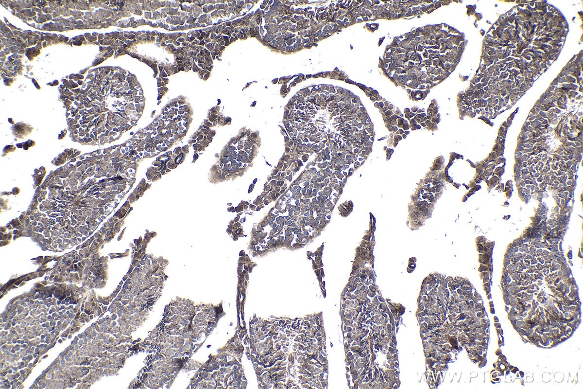 Immunohistochemical analysis of paraffin-embedded mouse testis tissue slide using KHC0995 (SEPT7 IHC Kit).