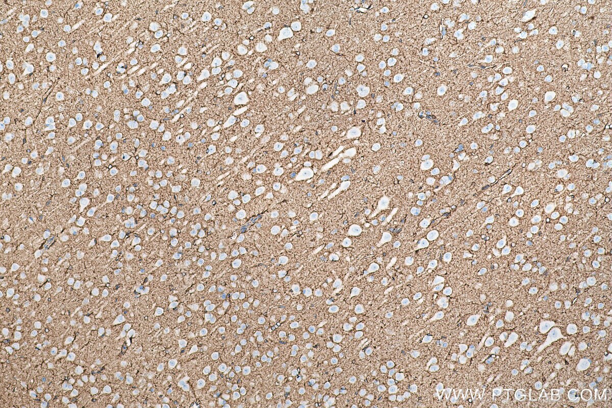 Immunohistochemical analysis of paraffin-embedded rat brain tissue slide using KHC0726 (SEPTIN2 IHC Kit).