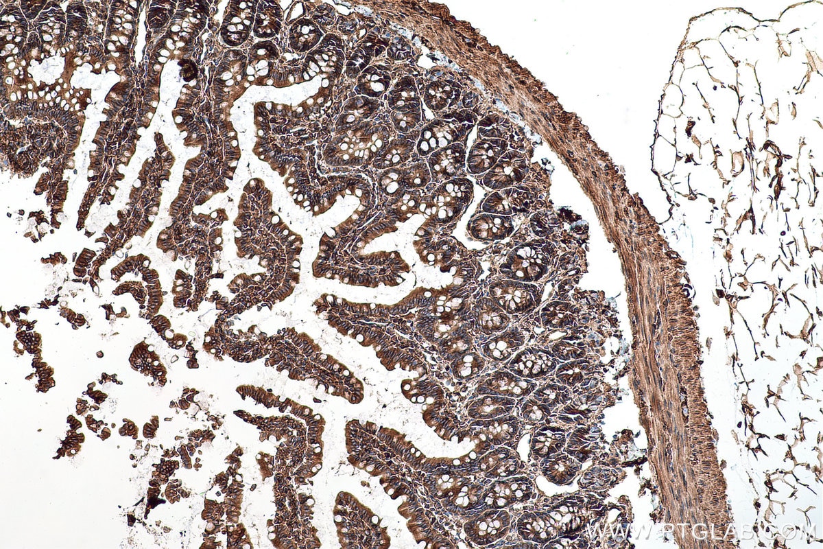 Immunohistochemical analysis of paraffin-embedded rat small intestine tissue slide using KHC0726 (SEPTIN2 IHC Kit).