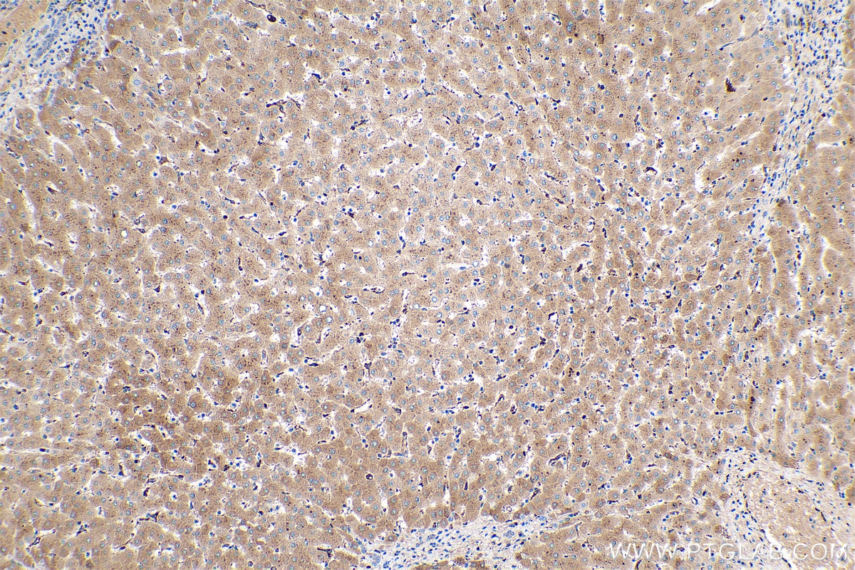 Immunohistochemical analysis of paraffin-embedded human liver tissue slide using KHC0458 (Alpha Antichymotrypsin IHC Kit).