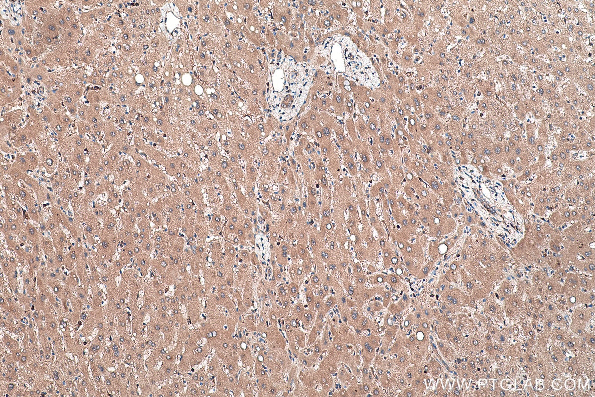 Immunohistochemical analysis of paraffin-embedded human liver tissue slide using KHC0459 (SERPINB8 IHC Kit).