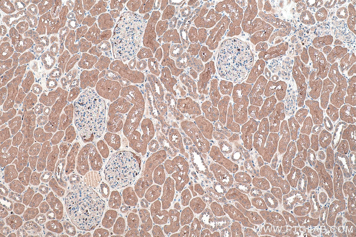 Immunohistochemical analysis of paraffin-embedded human kidney tissue slide using KHC0459 (SERPINB8 IHC Kit).