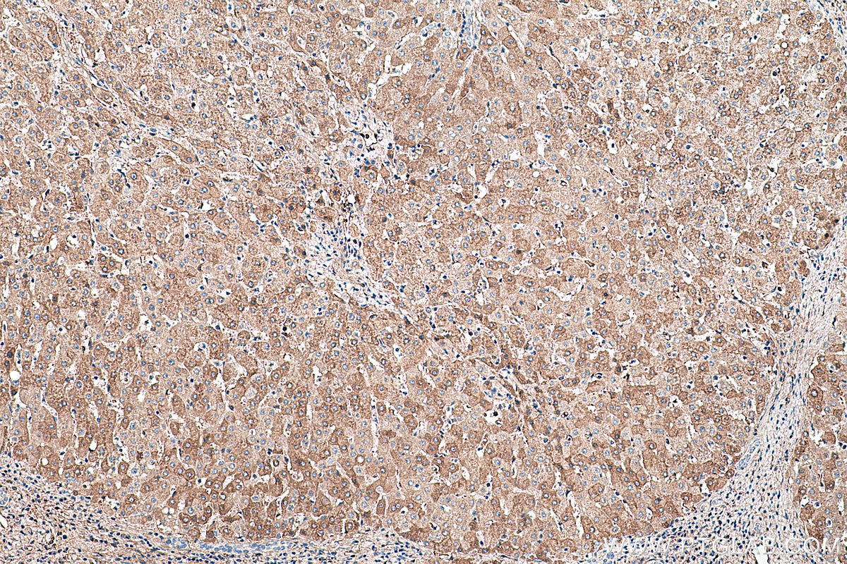 Immunohistochemical analysis of paraffin-embedded human liver tissue slide using KHC0460 (SERPINC1 IHC Kit).