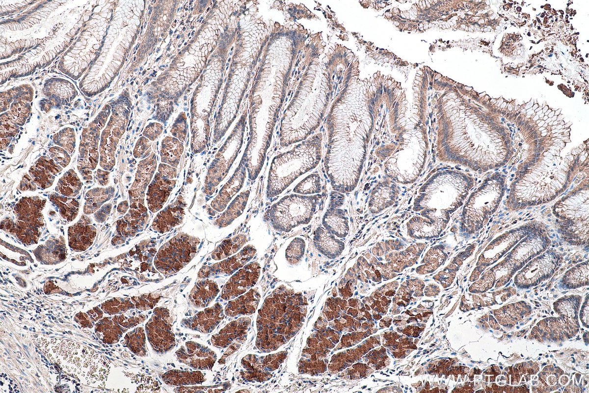 Immunohistochemical analysis of paraffin-embedded human stomach cancer(NAT) tissue slide using KHC0461 (SERPINE1 IHC Kit).