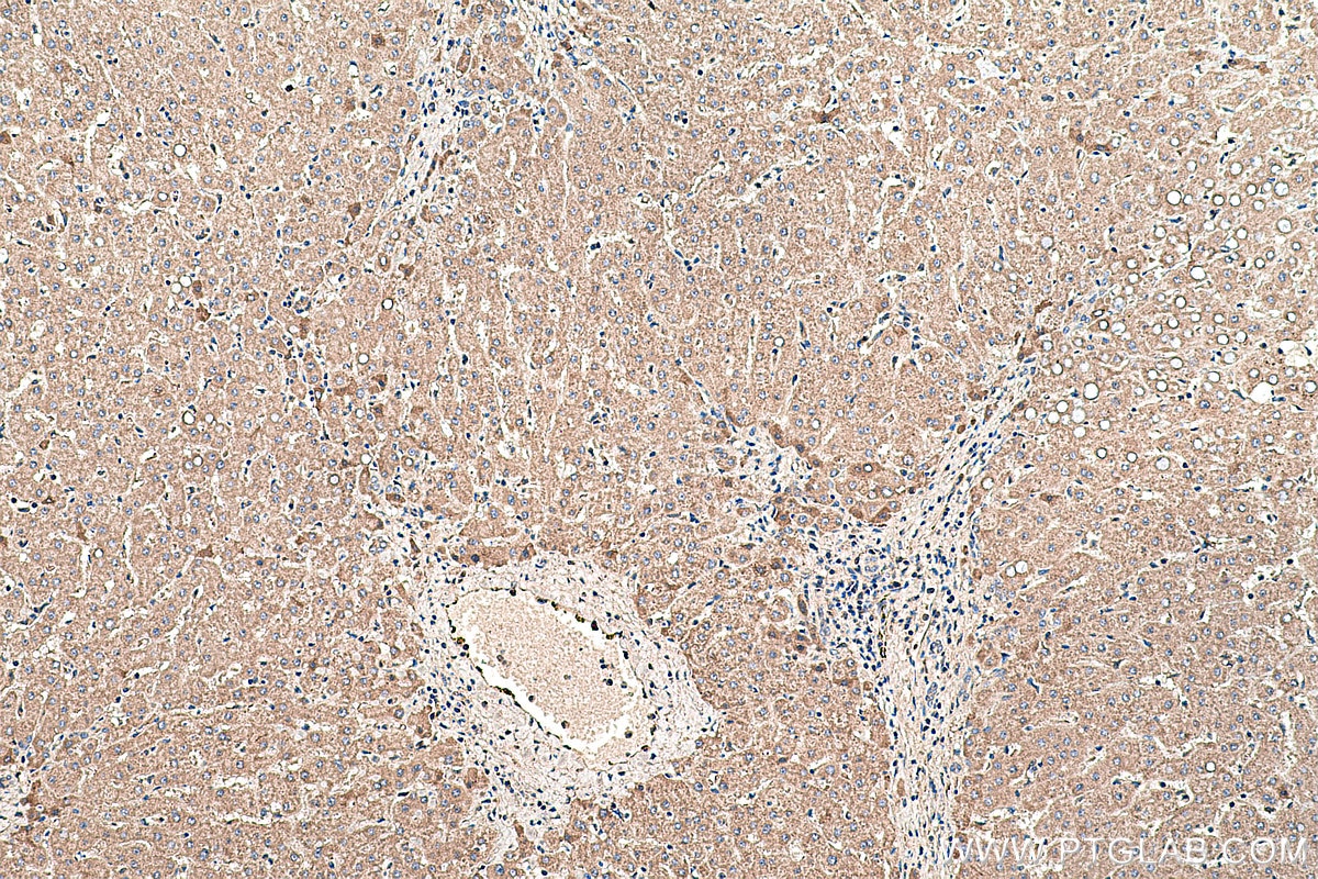 Immunohistochemical analysis of paraffin-embedded human liver tissue slide using KHC0462 (SERPINF1/PEDF IHC Kit).