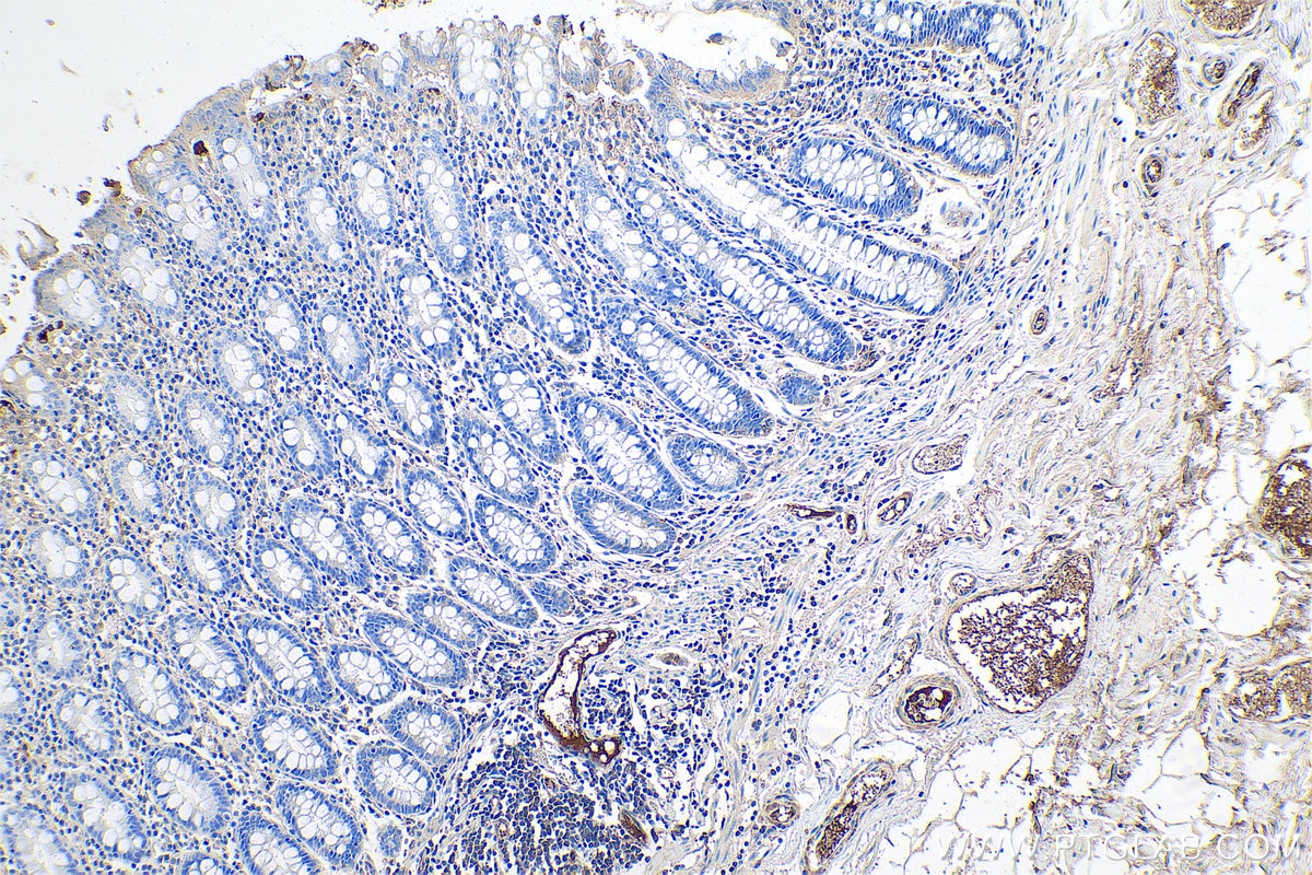 Immunohistochemical analysis of paraffin-embedded human colon tissue slide using KHC0741 (SERPING1 IHC Kit).