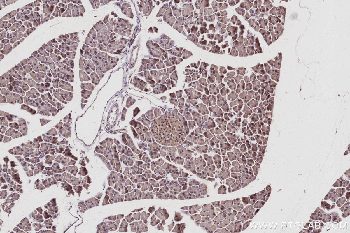 Immunohistochemical analysis of paraffin-embedded mouse pancreas tissue slide using KHC3011 (SERTAD1 IHC Kit).