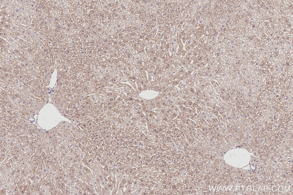 Immunohistochemical analysis of paraffin-embedded mouse liver tissue slide using KHC3011 (SERTAD1 IHC Kit).