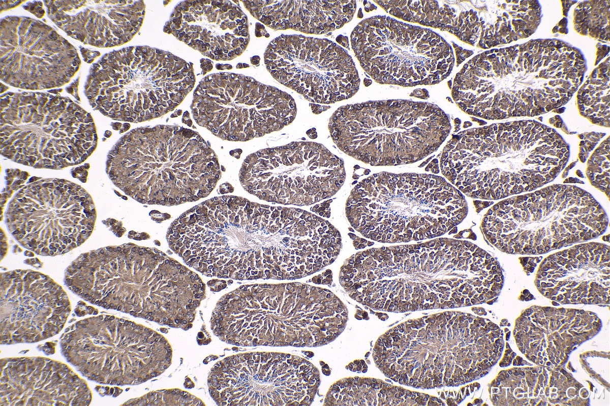 Immunohistochemical analysis of paraffin-embedded mouse testis tissue slide using KHC1807 (SETD3 IHC Kit).