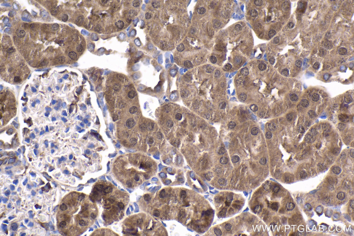 Immunohistochemical analysis of paraffin-embedded rat kidney tissue slide using KHC1807 (SETD3 IHC Kit).