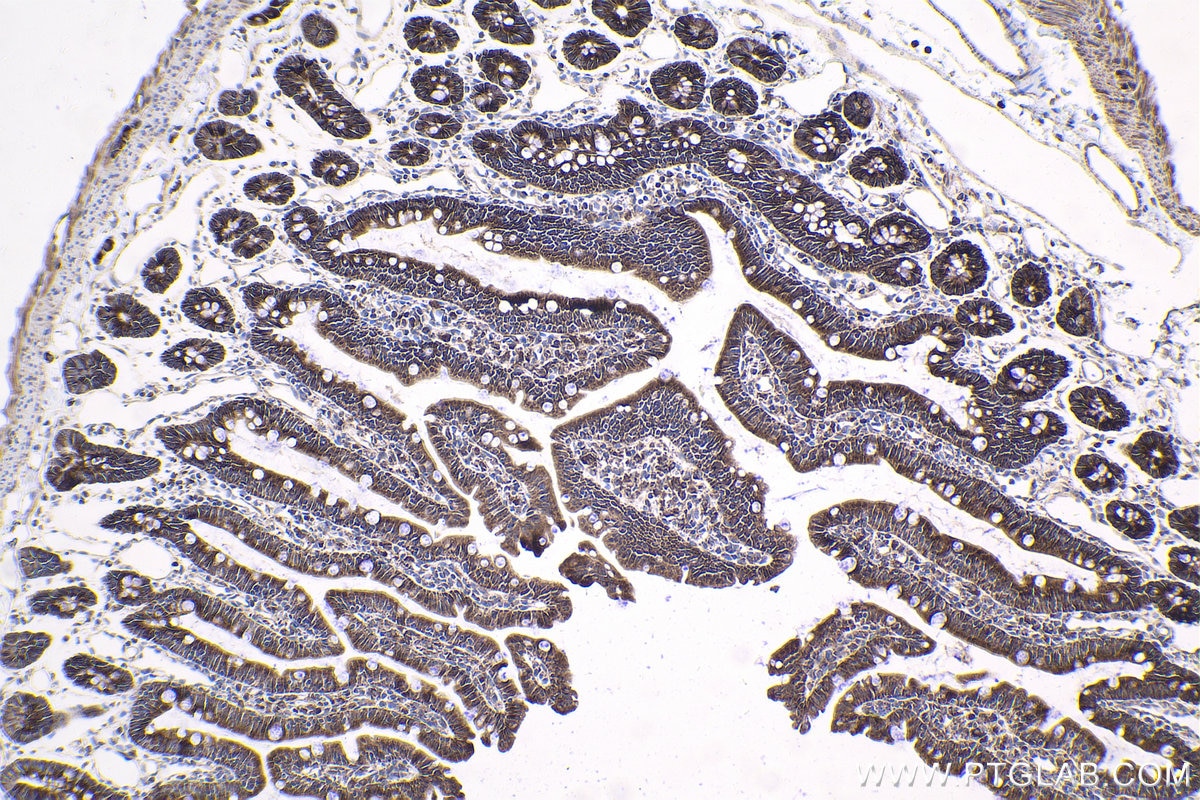 Immunohistochemical analysis of paraffin-embedded rat small intestine tissue slide using KHC1807 (SETD3 IHC Kit).