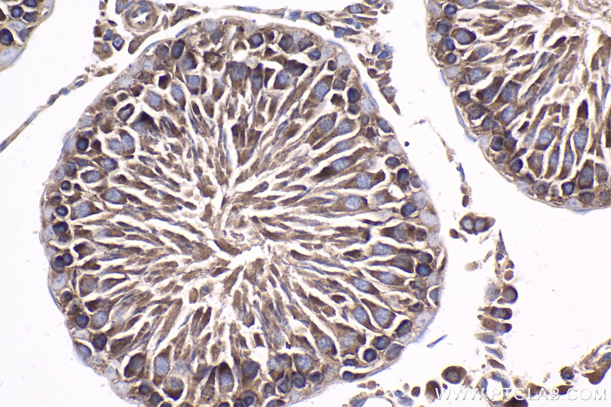 Immunohistochemical analysis of paraffin-embedded rat testis tissue slide using KHC1807 (SETD3 IHC Kit).