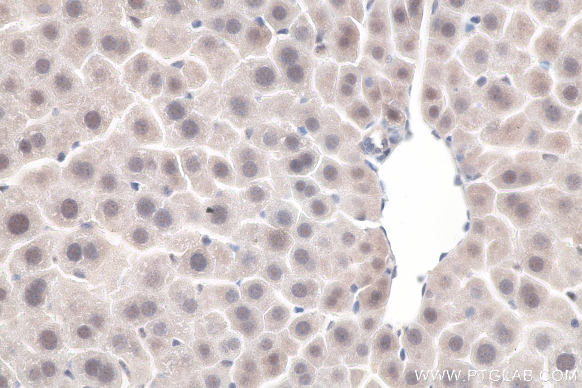 Immunohistochemical analysis of paraffin-embedded mouse liver tissue slide using KHC0067 (SETDB1 IHC Kit).