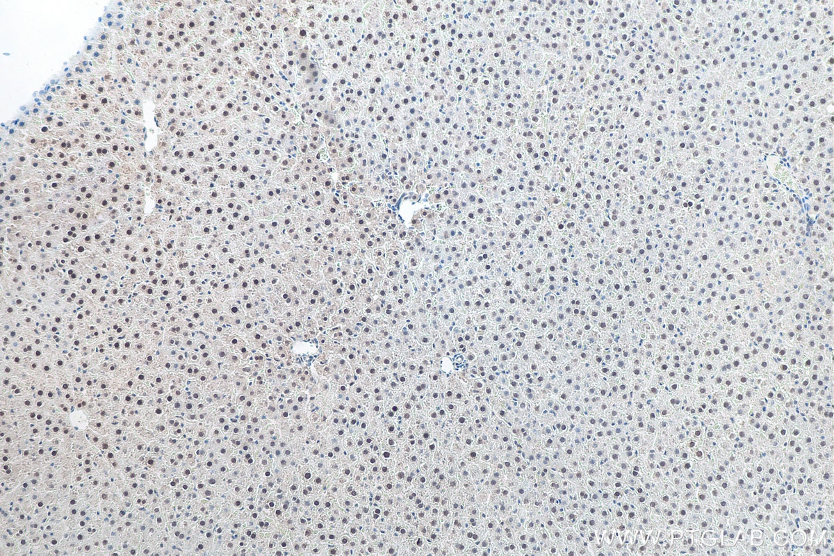 Immunohistochemical analysis of paraffin-embedded rat liver tissue slide using KHC0067 (SETDB1 IHC Kit).
