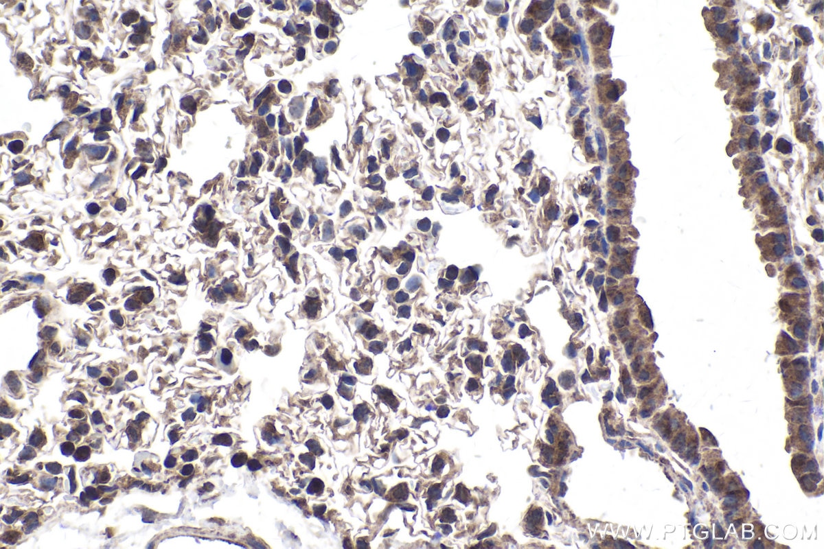 Immunohistochemical analysis of paraffin-embedded mouse lung tissue slide using KHC1801 (SETX IHC Kit).