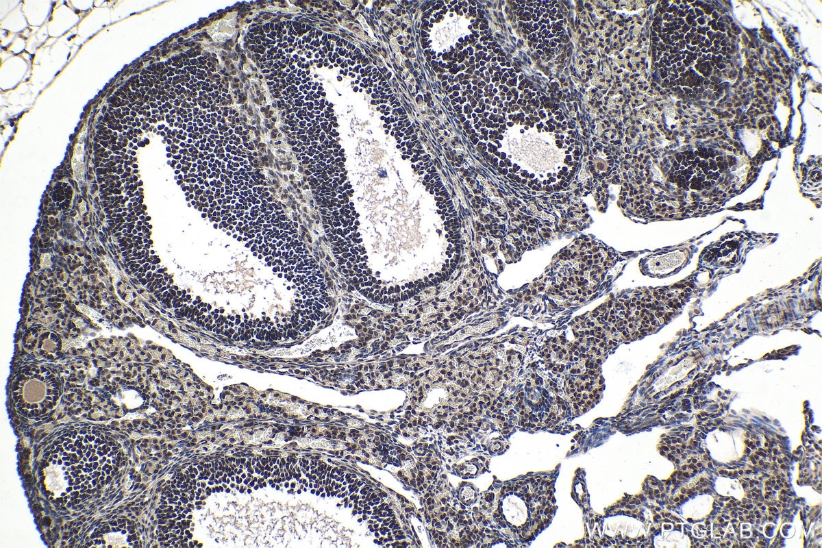 Immunohistochemical analysis of paraffin-embedded mouse ovary tissue slide using KHC1438 (SF1 IHC Kit).