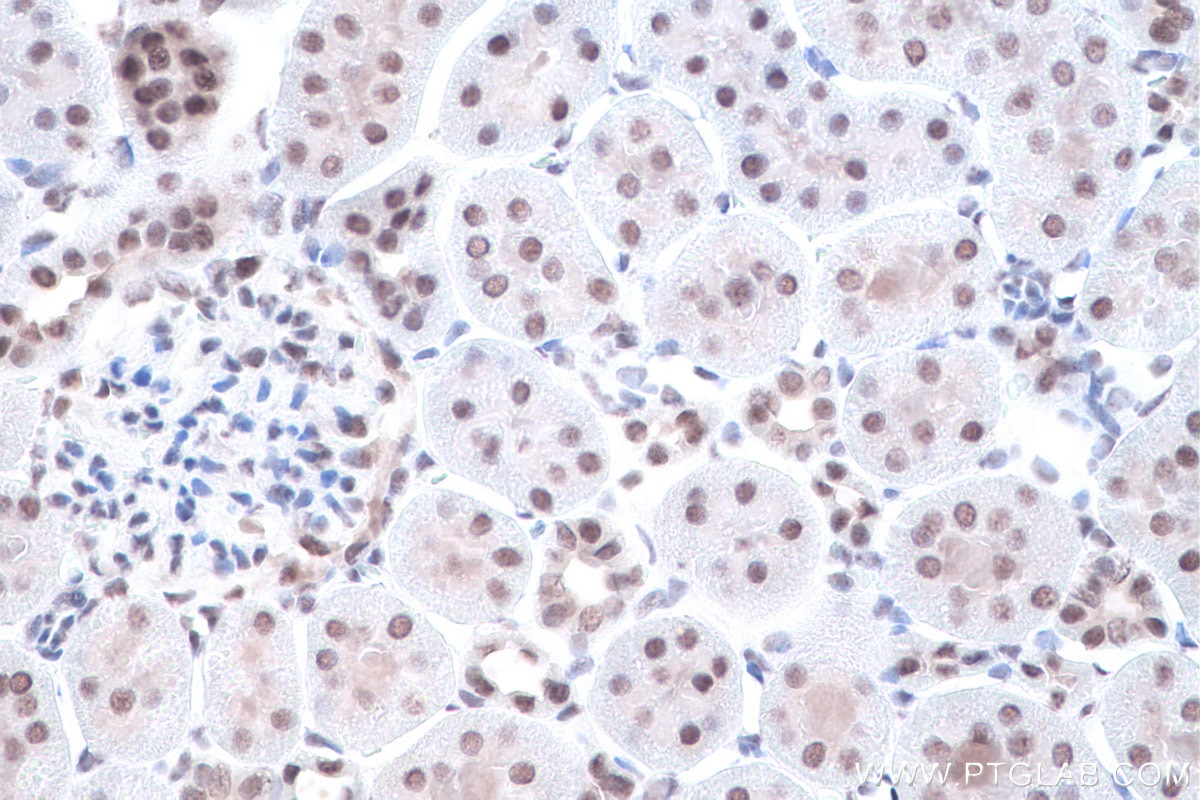 Immunohistochemical analysis of paraffin-embedded rat kidney tissue slide using KHC0906 (SF3A1 IHC Kit).