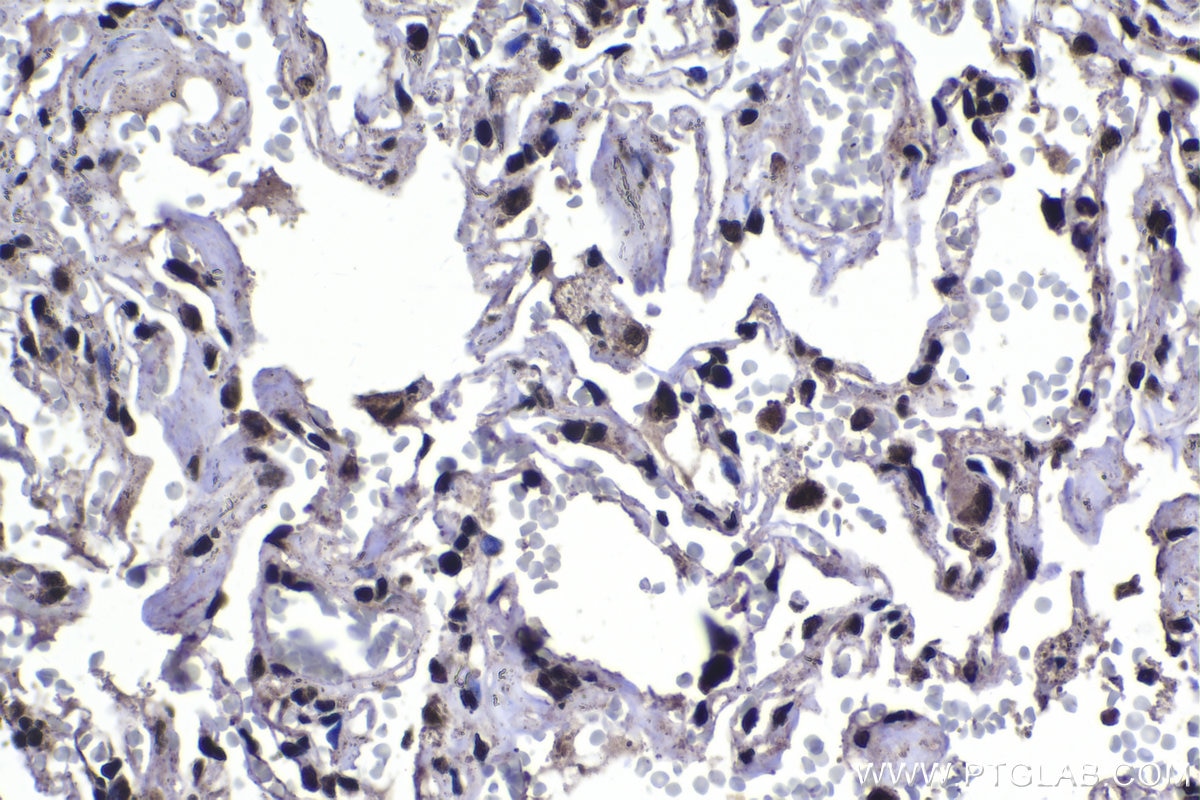 Immunohistochemical analysis of paraffin-embedded human lung tissue slide using KHC1406 (SF3A3 IHC Kit).