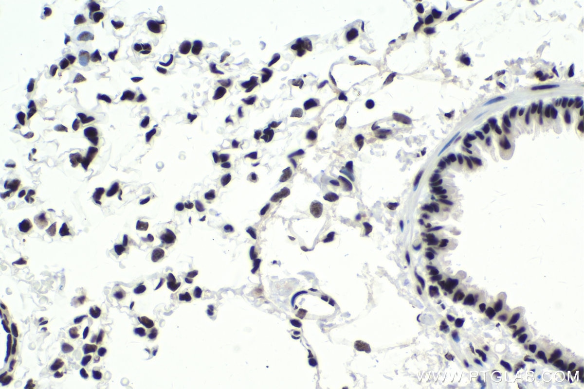 Immunohistochemical analysis of paraffin-embedded rat lung tissue slide using KHC1751 (SF3B3 IHC Kit).