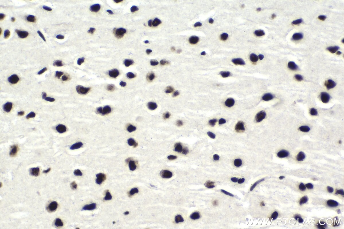 Immunohistochemical analysis of paraffin-embedded rat brain tissue slide using KHC1751 (SF3B3 IHC Kit).