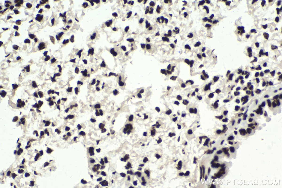 Immunohistochemical analysis of paraffin-embedded mouse lung tissue slide using KHC1751 (SF3B3 IHC Kit).