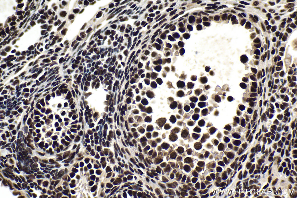 Immunohistochemical analysis of paraffin-embedded mouse ovary tissue slide using KHC1751 (SF3B3 IHC Kit).