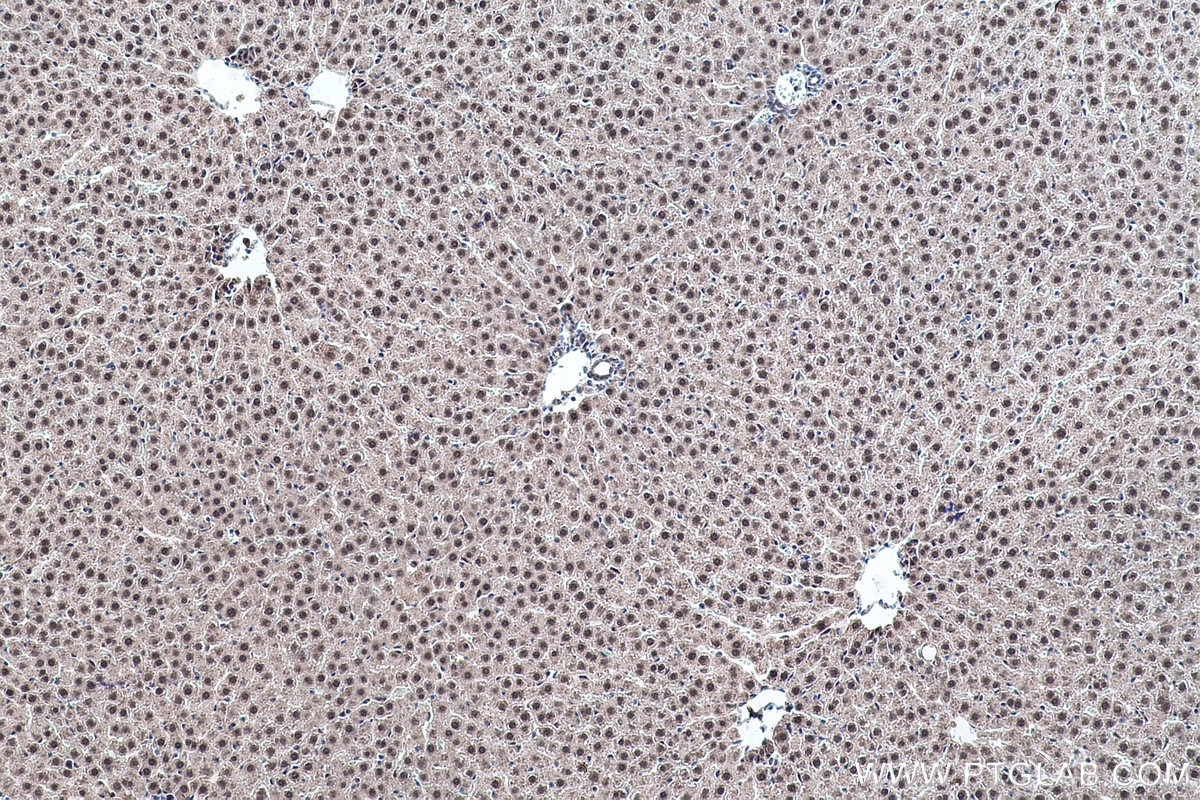 Immunohistochemical analysis of paraffin-embedded rat liver tissue slide using KHC0463 (SF3B5 IHC Kit).