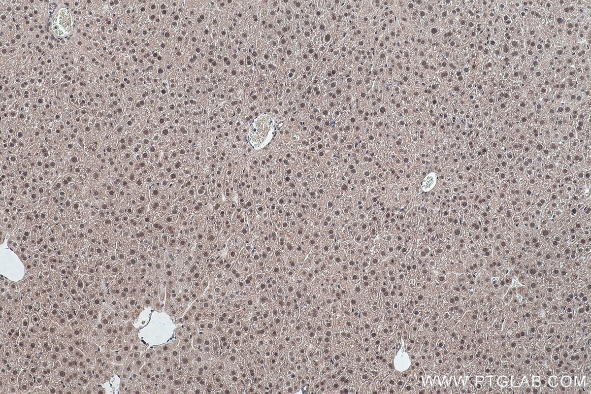 Immunohistochemical analysis of paraffin-embedded mouse liver tissue slide using KHC0463 (SF3B5 IHC Kit).