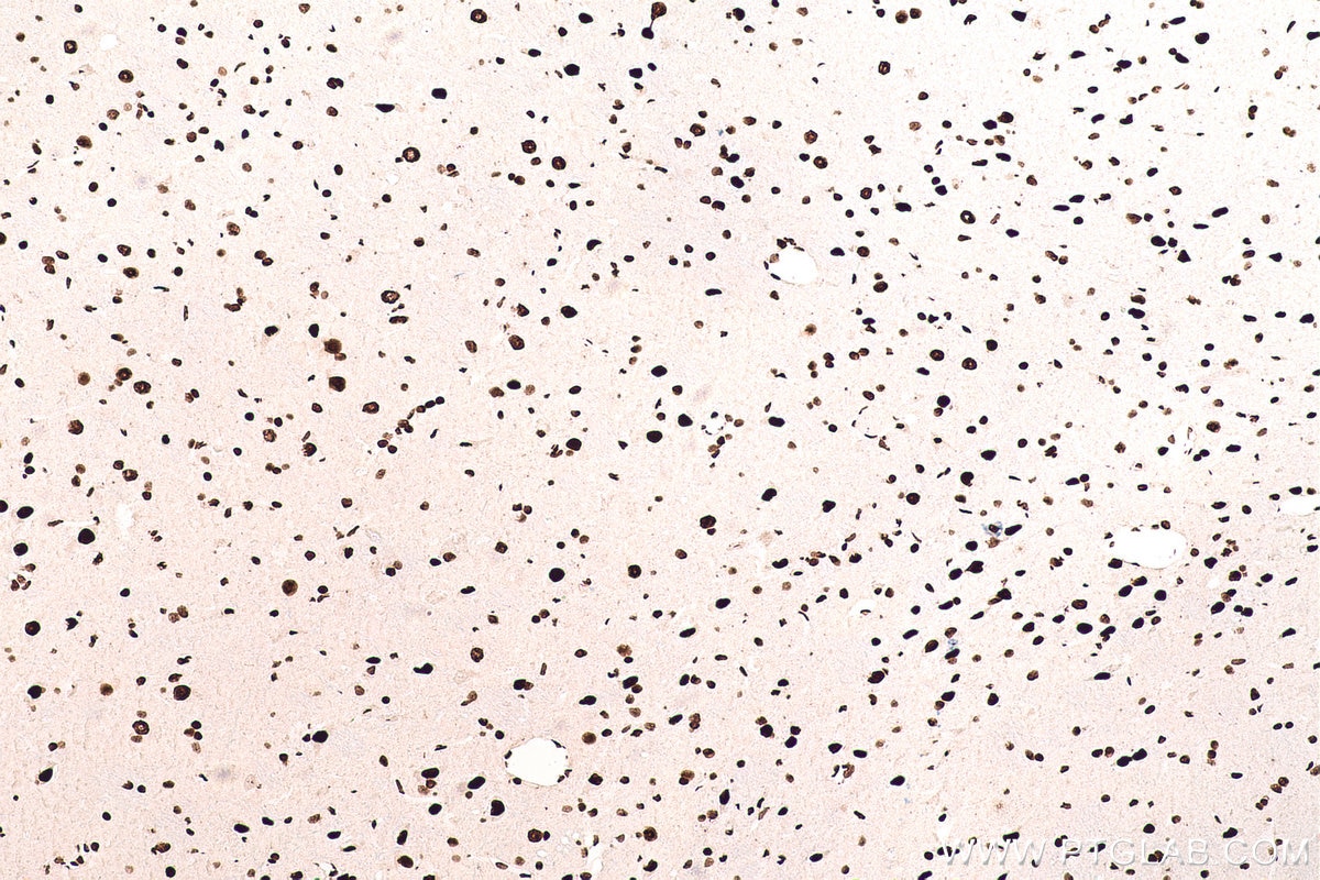 Immunohistochemical analysis of paraffin-embedded rat brain tissue slide using KHC0710 (SFPQ IHC Kit).