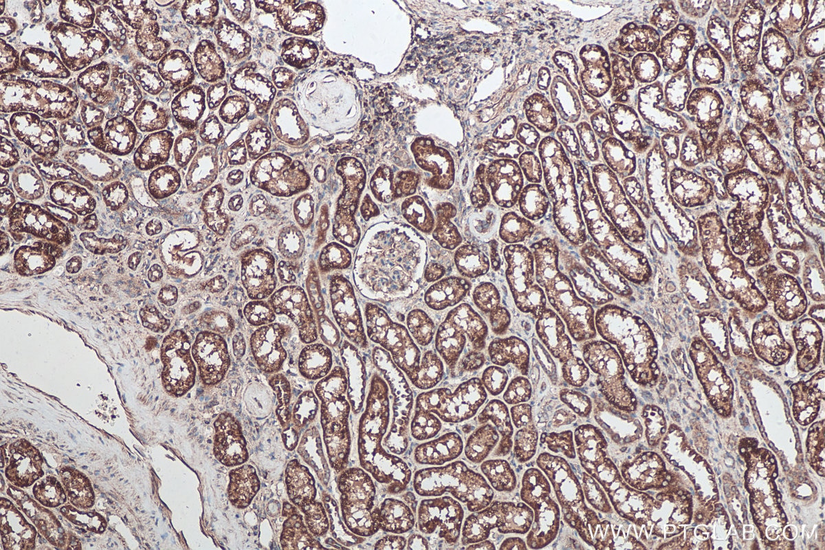 Immunohistochemical analysis of paraffin-embedded human kidney tissue slide using KHC0215 (SFRP1 IHC Kit).