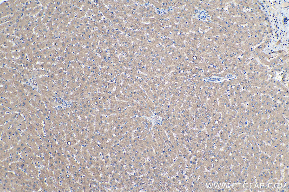 Immunohistochemical analysis of paraffin-embedded human liver tissue slide using KHC0475 (SFRP4 IHC Kit).