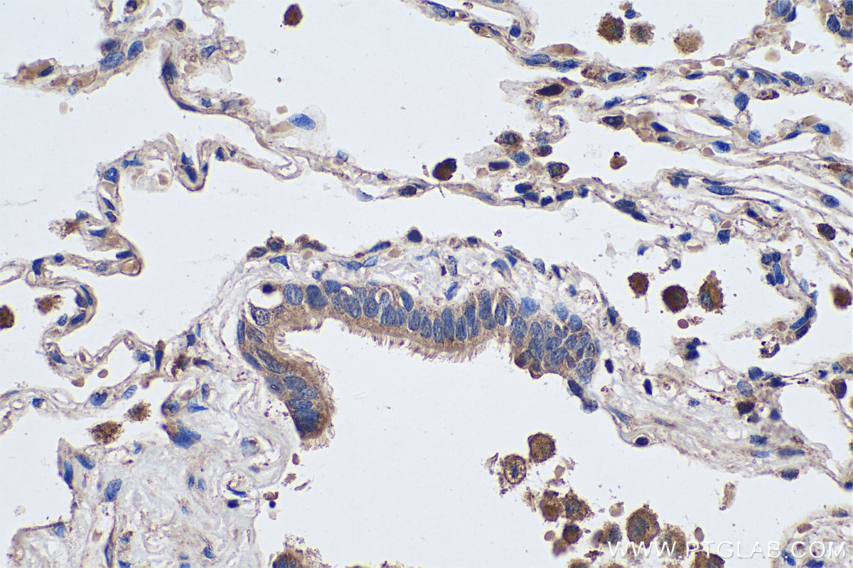 Immunohistochemical analysis of paraffin-embedded human lung tissue slide using KHC0475 (SFRP4 IHC Kit).