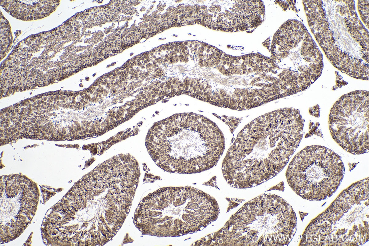 Immunohistochemical analysis of paraffin-embedded mouse testis tissue slide using KHC0165 (SFRS2 IHC Kit).