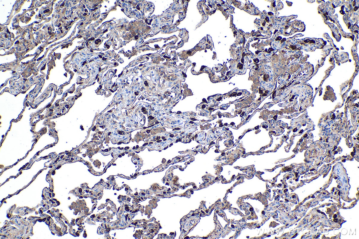 Immunohistochemical analysis of paraffin-embedded human lung tissue slide using KHC1099 (SFTPB IHC Kit).