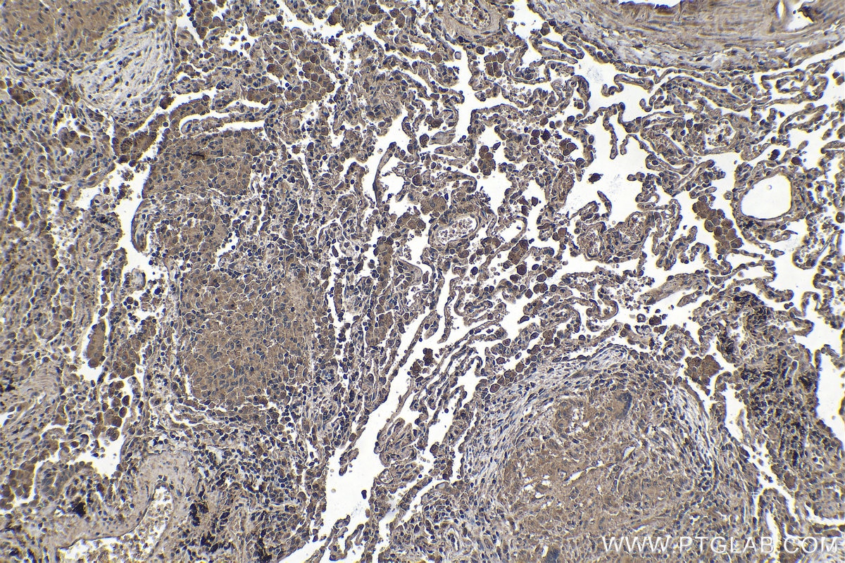 Immunohistochemical analysis of paraffin-embedded human lung tissue slide using KHC1416 (SGK1 IHC Kit).