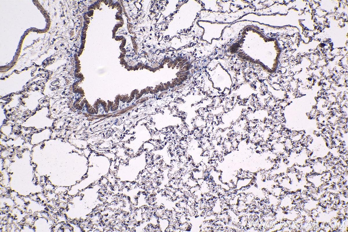 Immunohistochemical analysis of paraffin-embedded rat lung tissue slide using KHC1416 (SGK1 IHC Kit).