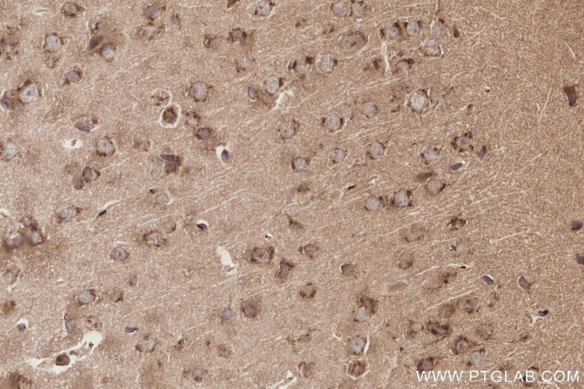 Immunohistochemical analysis of paraffin-embedded mouse brain tissue slide using KHC3284 (SGMS1 IHC Kit).