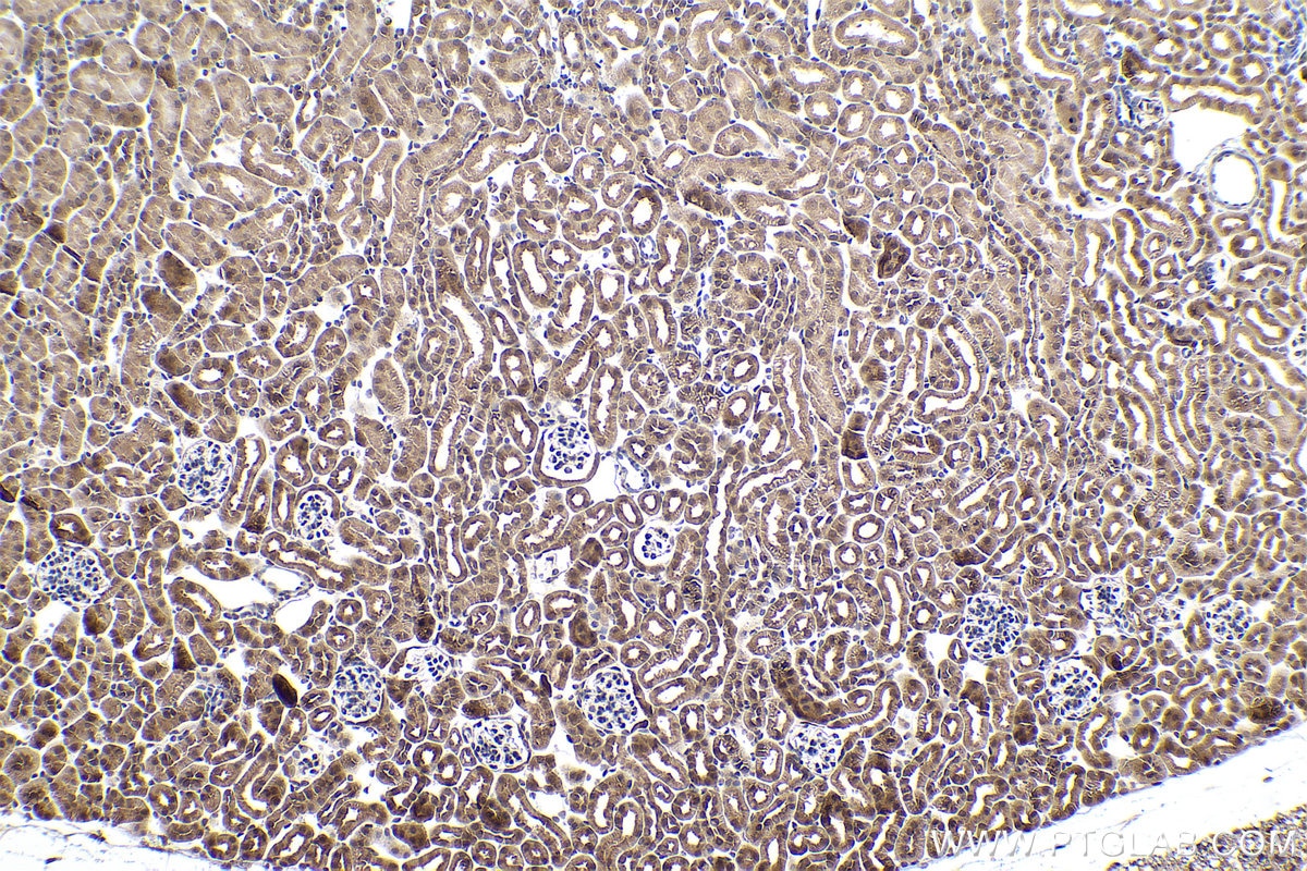 Immunohistochemical analysis of paraffin-embedded mouse kidney tissue slide using KHC0875 (SGTA IHC Kit).