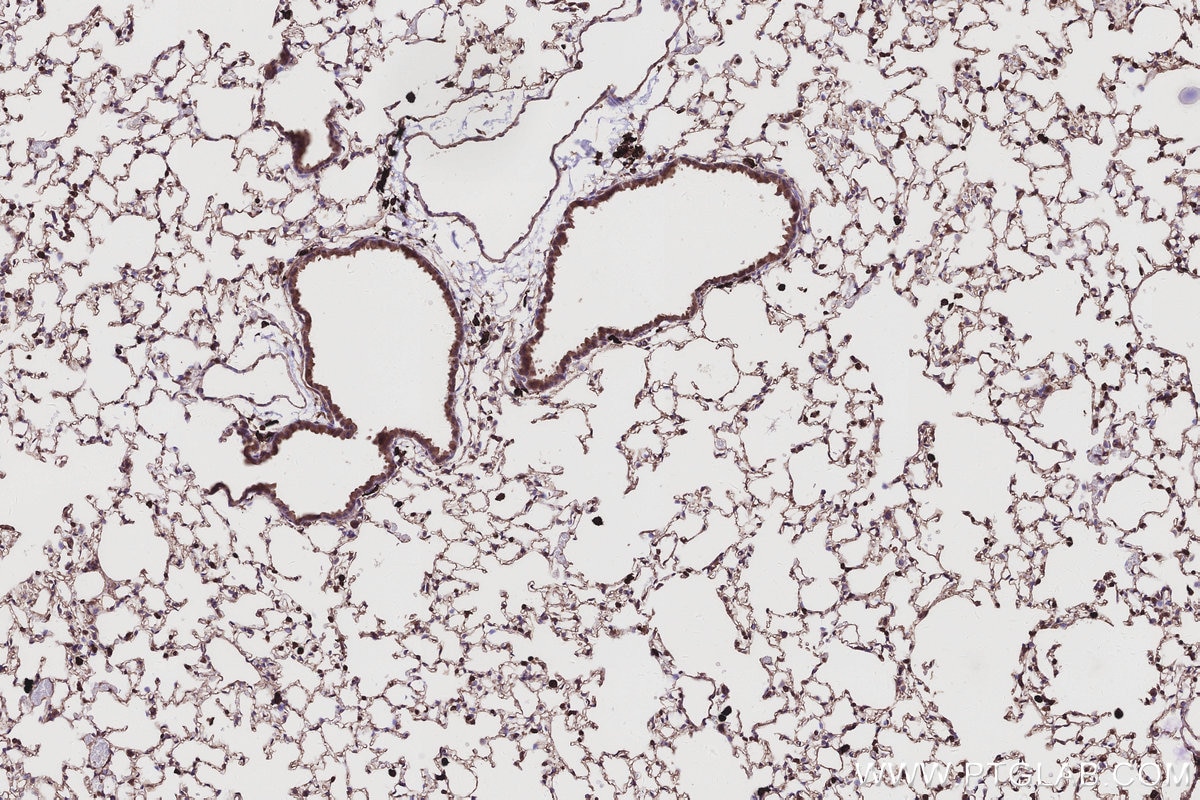 Immunohistochemical analysis of paraffin-embedded mouse lung tissue slide using KHC2986 (SH3BP4 IHC Kit).