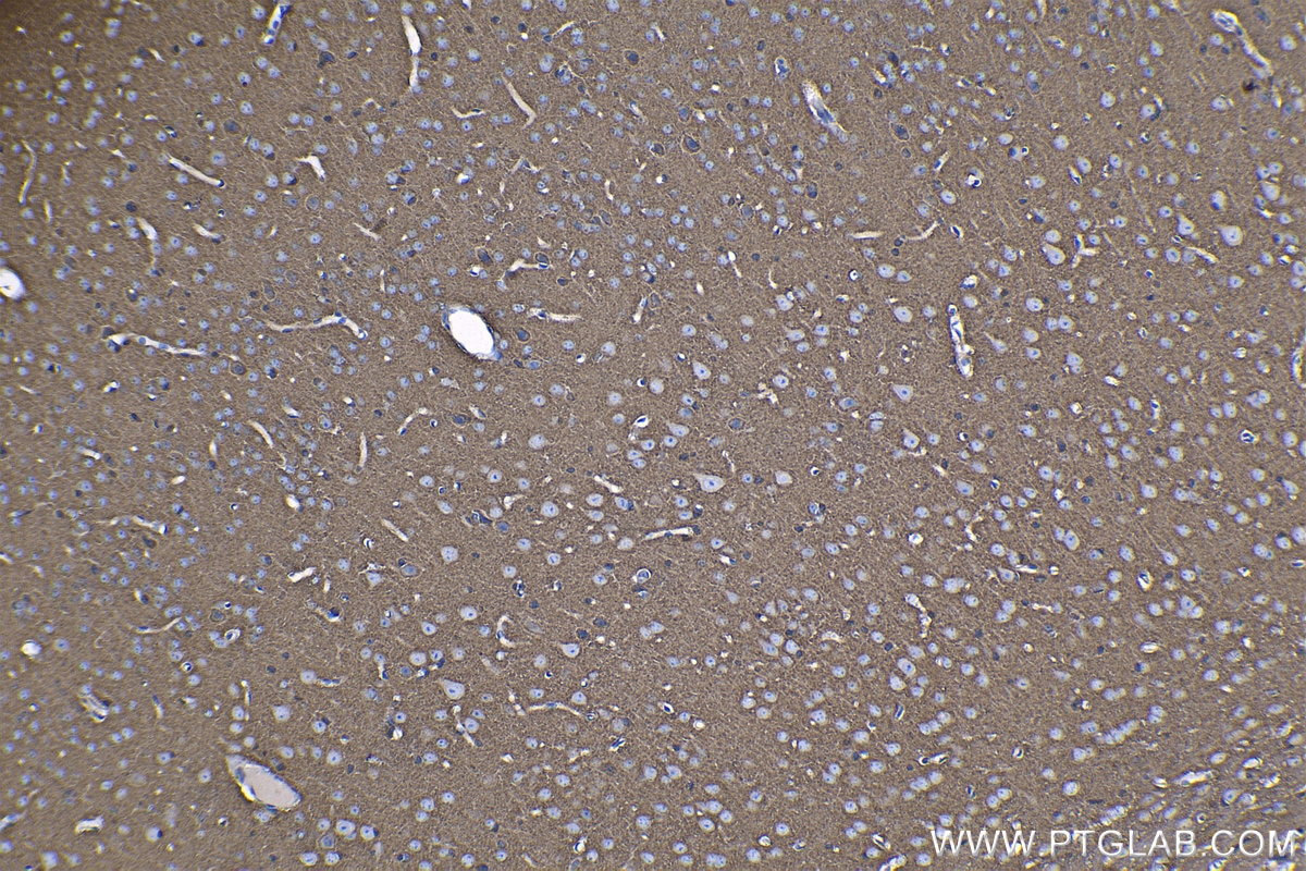 Immunohistochemical analysis of paraffin-embedded mouse brain tissue slide using KHC1260 (SH3GLB2 IHC Kit).