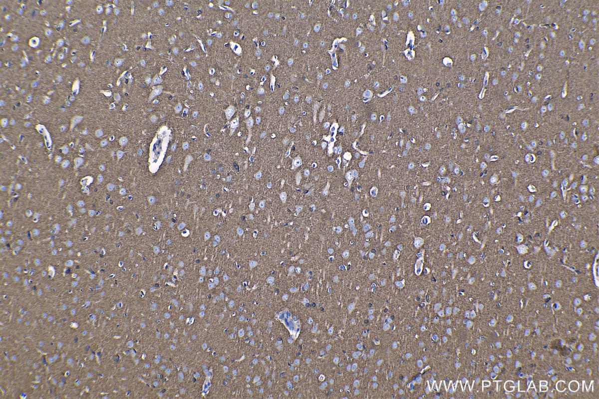 Immunohistochemical analysis of paraffin-embedded rat brain tissue slide using KHC1260 (SH3GLB2 IHC Kit).