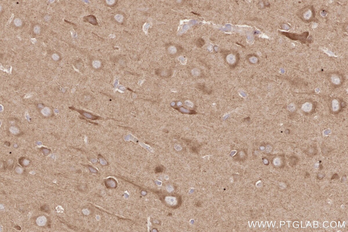 Immunohistochemical analysis of paraffin-embedded rat brain tissue slide using KHC2625 (SH3RF1/POSH IHC Kit).